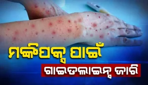 MONKEY POX